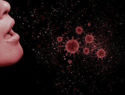 Campak Lebih Menular dari Covid-19